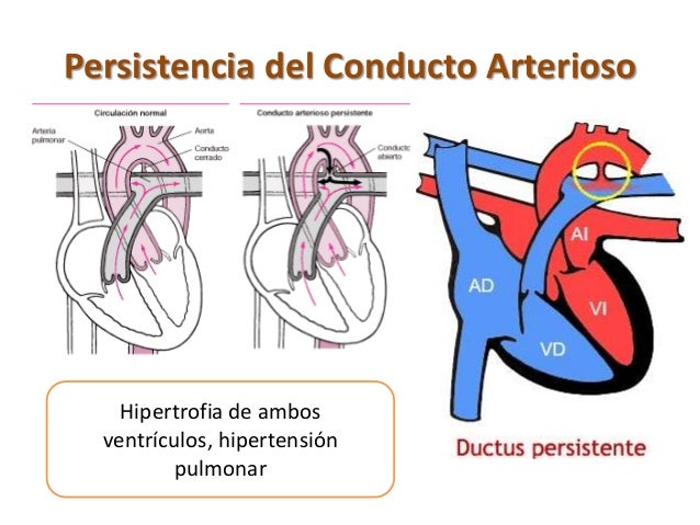conducto arterioso persistente en perros